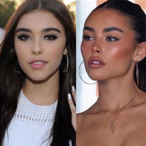 madison beer plastic surgery